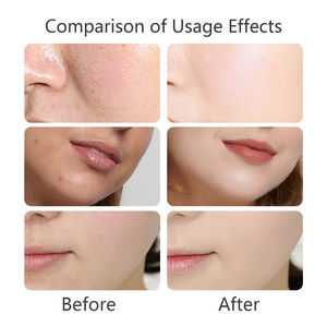 <span class=keywords><strong>Limpiador</strong></span> <span class=keywords><strong>Facial</strong></span> Diario con Esencia de Trufa Blanca Premium OEM, Antioxidante, Iluminador e Hidratante para Todo Tipo de Piel - Product Image 4