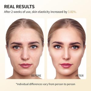Crema de Noche de Marca Blanca Superior para Manchas Oscuras y Pecas, Crema <span class=keywords><strong>Facial</strong></span> de Arroz OEM Iluminadora y Blanqueadora, Hidratación <span class=keywords><strong>Facial</strong></span> - Product Image 2