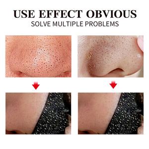 <span class=keywords><strong>Masque</strong></span> <span class=keywords><strong>Peel</strong></span>-<span class=keywords><strong>Off</strong></span> Purifiant au Charbon de Bambou pour Nettoyage des Pores, Réduction des Points Noirs et des Points Blancs, Marque Privée - Product Image 3