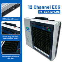 Appareil ECG portable 12 canaux 12 dérivations avec écran tactile, impression thermique, batterie longue durée (jusqu'à 10 heures), certifié CE