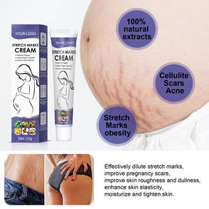 Crème d'élimination des vergetures réparatrice naturelle et biologique pour l'élimination des vergetures - Product Image 3