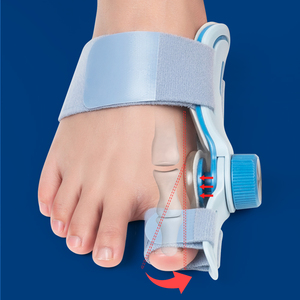 Corrector de dedos con función ajustable, regulador de hueso de juanete nocturno para aliviar los dedos de los pies, efectivo para empeorar el dolor nocturno - Product Image 1