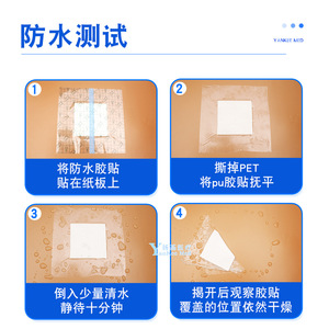 Apósito médico de película de PU impermeable, cinta adhesiva transparente para el cuidado de heridas, tamaño grande - Product Image 2