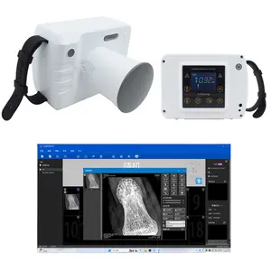 60KV 2mA Portable High Frequency Dental X-Ray Machine LCD Display Colorful Screen Imaging System X Ray Camera