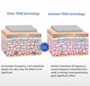 Masajeador TENS Multifuncional para el Hogar, Producto de Salud Inteligente con Microelectroterapia y Múltiples Accesorios - Product Image 4