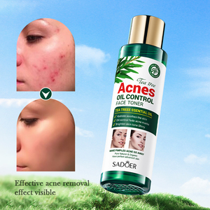 SADOER Tea Tree Anti Acne Toner Control de aceite <span class=keywords><strong>Tónico</strong></span> <span class=keywords><strong>facial</strong></span> Hidratante Cuidado de la <span class=keywords><strong>piel</strong></span> <span class=keywords><strong>para</strong></span> <span class=keywords><strong>piel</strong></span> <span class=keywords><strong>grasa</strong></span> y propensa al acné - Product Image 4