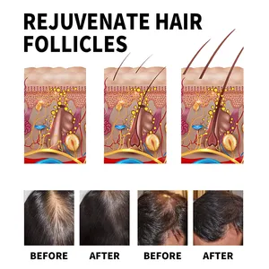 Etiqueta privada 100% Natural Herbal Organic Alta calidad Tratamiento para la pérdida del cuidado del cuero cabelludo Suero de aceite para el crecimiento del cabello de Romero para el cabello