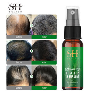 男性と女性のためのホットセール30ml脱毛治療血清ヘアオイルオーガニックナチュラルローズマリー育毛オイル栄養素ソリューション - Product Image 5