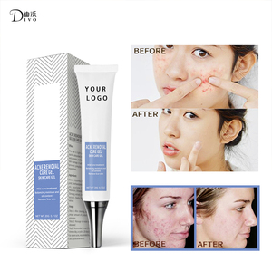 Label privé 20G Gel <span class=keywords><strong>de</strong></span> traitement <span class=keywords><strong>pour</strong></span> l'élimination <span class=keywords><strong>de</strong></span> l'acné végétalien Gel <span class=keywords><strong>pour</strong></span> soins <span class=keywords><strong>de</strong></span> <span class=keywords><strong>la</strong></span> <span class=keywords><strong>peau</strong></span> contre l'acné - Product Image 6
