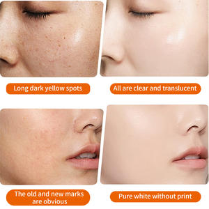 Productos de Belleza para el Cuidado Facial Blanqueadores al por Mayor, Set de Cuidado de la Piel con Vitamina C Iluminadora para Mujeres - Product Image 2