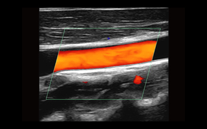 Échographe Doppler Couleur Mindary Z.One PRO sur Chariot pour Usage Vétérinaire avec Échographie et Diagnostic Ultrasonore Haute Définition - Product Image 5