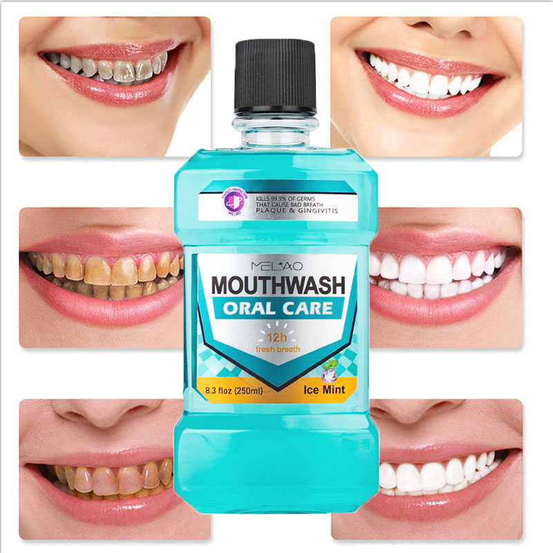 Mouth Wash Oral Hygiene Products Fight Bad Breath 250ml Custom Mouthwash