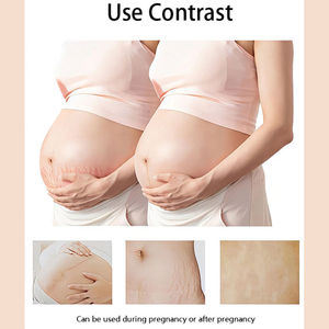 Meilleure crème de réparation organique 100% naturelle végétalienne pour femme, crème contre les vergetures, marque privée - Product Image 3