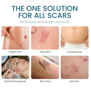 Gel d'élimination des cicatrices de marque privée pour les vergetures Cicatrices d'acné Meilleure vente OEM Crème anti-cicatrice Fade Old New Scars Fast - Product Image 4