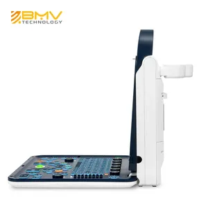 Medische Diagnostische Draagbare Kleur Doppler Echografie Systeem Gyn Ultrasound Machine Prijs Trolley Medische Echografie Instrumenten