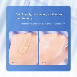 Crème Pieds et Mains HIH Anti-Gerçures en Gros, Élimination des Peaux Mortes, Hydratante et Apaisante pour Soins de la Peau - Product Image 5