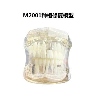 Modèle de restauration d'implant dentaire M2001, modèle de pathologie dentaire en silicone médical transparent pour exposition scientifique médicale - Product Image 5