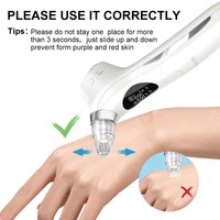 Portable 5 têtes pores nettoyant aspirateur électrique aspiration visage acné dissolvant extracteur outil Kit vide points noirs dissolvant