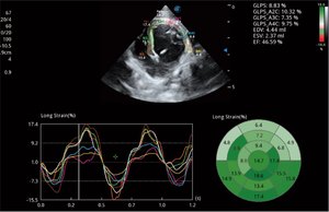 Échographe vétérinaire Sonoscape Propet 60 à haute résistance à l'abrasion avec imagerie Doppler du flux sanguin pour animaux de compagnie - Product Image 6