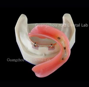 उच्च गुणवत्ता वाले व्यक्तिगत अनुकूलन पूर्ण-मुंह वाले डेबेंचर मुंह में बड़ी संख्या में लापता दांतों की मरम्मत - Product Image 6