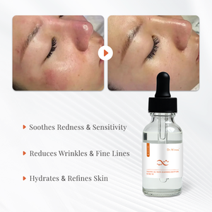 Sérum Esthétique Médical à l'Ectoïne avec Compte-gouttes – Soin Après-Soleil Hydratation Intense et Récupération Cutanée – Traitement Facial - Product Image 3