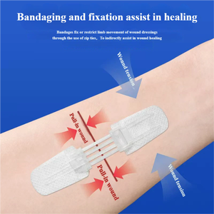 Cierres de Heridas de Emergencia con Cierre de Cremallera, Indoloros, Ajustables, Envueltos Individualmente y de Alta Adhesión, Aptos <span class=keywords><strong>para</strong></span> Primeros Auxilios y Cuidado de Heridas - Product Image 3