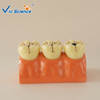 Modelo de Descomposición de Caries Dentales con Aumento 4X, Modelo Desmontable de la Estructura Interna del Diente Deciduado, CE/ISO/ROHS/CNAS