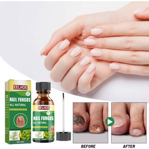 Kit EELHOE per Micosi delle <span class=keywords><strong>Unghie</strong></span> <span class=keywords><strong>dei</strong></span> <span class=keywords><strong>Piedi</strong></span> con Spazzola, Essenza Riparatrice per <span class=keywords><strong>Unghie</strong></span>, Trattamento Naturale per Micosi delle <span class=keywords><strong>Unghie</strong></span> <span class=keywords><strong>dei</strong></span> <span class=keywords><strong>Piedi</strong></span> 10ml/flacone - Product Image 4
