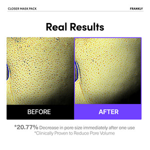 Masque hydratant FRANKLY Closer, riz fermenté et peptides pour un soin intensif des pores, fabriqué en Corée, usage unique - Product Image 4