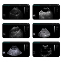 Échographe vétérinaire portable pour chèvres, appareil d'échographie B portatif pour le diagnostic de gestation chez les équidés, bovins et canins