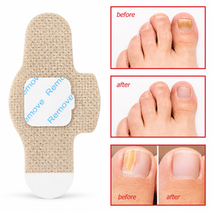 Meilleure Vente : Patchs de Réparation <span class=keywords><strong>des</strong></span> <span class=keywords><strong>Ongles</strong></span> en Gel Anti-Fongique, Force Extra, Réparation Nuit 8H, Renouvellement <span class=keywords><strong>des</strong></span> <span class=keywords><strong>Ongles</strong></span> Abîmés - Product Image 2