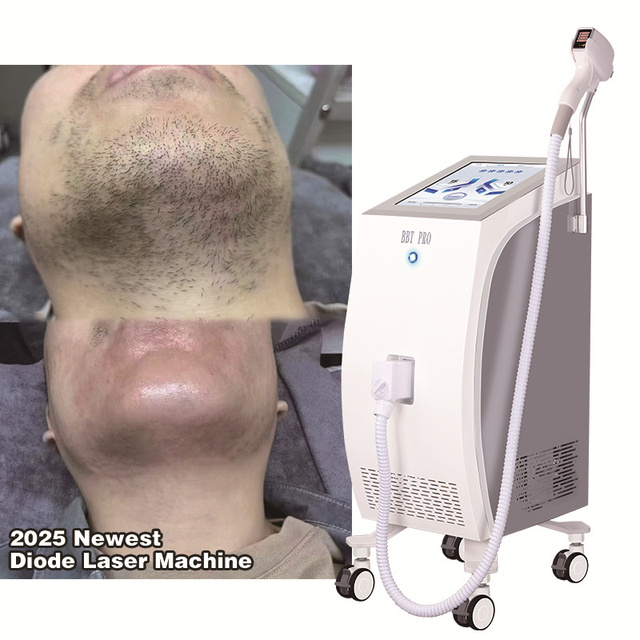 ZS Manufacturer Painless Hair Removal Machine Fast Hair Removal Skin Rejuvenation Photon Facial Skin Whitening Machine for Salon