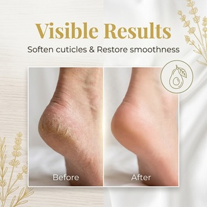 Maschera Esfoliante Piedi Cruelty-Free con Avocado e Zenzero per Rimozione Calli e <span class=keywords><strong>Talloni</strong></span> Screpolati - Trattamento Pedicure Spa - Product Image 4