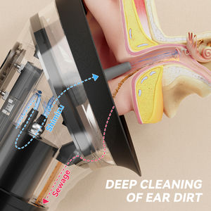 Irrigador <span class=keywords><strong>de</strong></span> <span class=keywords><strong>oídos</strong></span> <span class=keywords><strong>eléctrico</strong></span> inteligente portátil OEM/ODM al por mayor Kit <span class=keywords><strong>de</strong></span> herramientas <span class=keywords><strong>de</strong></span> eliminación <span class=keywords><strong>de</strong></span> cera <span class=keywords><strong>de</strong></span> los <span class=keywords><strong>oídos</strong></span> inalámbrico 230ML <span class=keywords><strong>limpiador</strong></span> <span class=keywords><strong>de</strong></span> <span class=keywords><strong>oídos</strong></span> con agua - Product Image 4