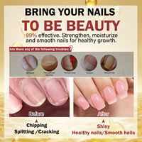 Huile pour cuticules fortifiant les ongles, huile nutritive pour ongles cassants, jaunis et fragiles, vente en gros