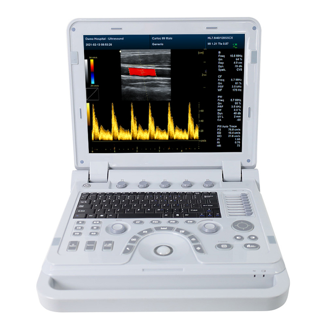 CONTEC CMS1700B Doppler Portable 3D 4D Ultrasound Equipment