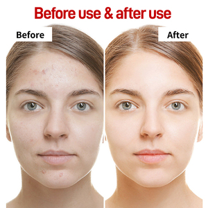 Kojic acid + Vitamin E sáng dầu | đốm đen mờ dần, điều trị tăng sắc tố & phát sáng - Product Image 6