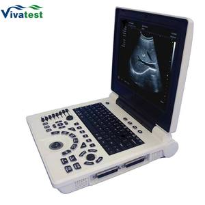 Vivatest - Instrumento de Diagnóstico por Ultrasonido Veterinario para Hospitales de Animales con Parámetros Preestablecidos Integrados para Varios Animales - Product Image 4
