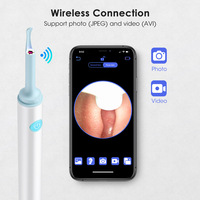 Nettoyeur de cire d'oreille intelligent pour otoscope d'outil de nettoyage de dissolvant sûr d'oreille avec cuillère de nettoyage de caméra photo et vidéo Earpick