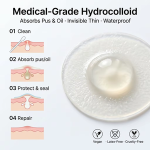 Parches Hidrocoloides Veganos y Libres de Crueldad para el Tratamiento de Granos, Parches para el Cuidado de <span class=keywords><strong>la</strong></span> Piel - Product Image 3