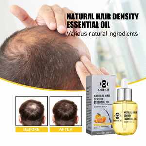 OUHOE Grosir Label Pribadi Menutrisi Kulit Kepala Merangsang Pertumbuhan Rambut Meningkatkan Kepadatan Rambut Minyak Esensial Pertumbuhan Rambut 30Ml - Product Image 4