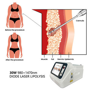 Lipólisis Avanzada con Fibra Óptica LAL de 1210nm para Eliminación de Grasa - Product Image 5