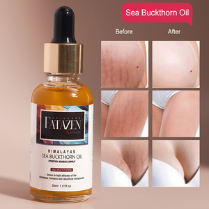 Produits de soin de la peau FATAZEN Huile essentielle de massage hydratante à <span class=keywords><strong>l</strong></span>'aloe vera Huile d'argousier pure pour vergetures OEM de marque privée - Product Image 3
