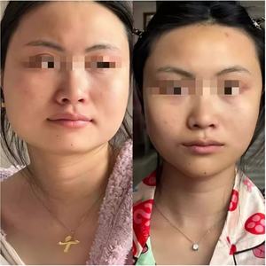 <span class=keywords><strong>Masque</strong></span> de contouring sculptant pour le visage au café au collagène, <span class=keywords><strong>lifting</strong></span> du visage, traitement raffermissant, élimination du double menton, <span class=keywords><strong>masque</strong></span> liftant - Product Image 2