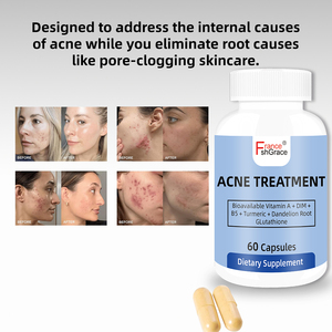 Fabricante Mayorista de Suplementos para el Acné, Vitaminas para una Piel Limpia, para Mujeres y Hombres, 60 Cápsulas - Product Image 2