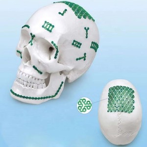 Y-Shaped Titanium Micro Locking Plates Maxillofacial <strong>Implants</strong> &amp; <strong>Interventional</strong> <strong>Materials</strong> with Locking Plate - Product Image 4