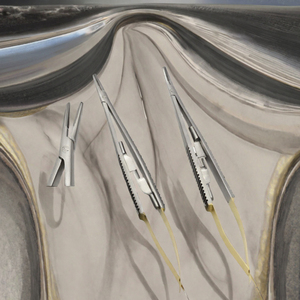 Portaagujas microdentales Castroviejo, portaagujas de acero inoxidable, instrumento de sutura de precisión para odontología, reutilizable, quirúrgico - Product Image 4