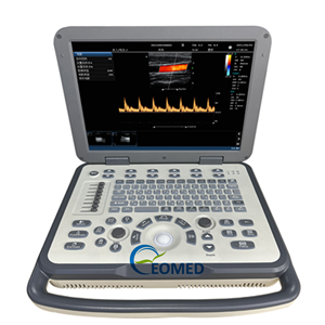 Échographie <span class=keywords><strong>Doppler</strong></span> de couleur d'ultrason humain de vétérinaire fiable idéale pour le diagnostic abdominal et cardiaque CU30-2 d'écho <span class=keywords><strong>Doppler</strong></span> <span class=keywords><strong>portatif</strong></span> - Product Image 1