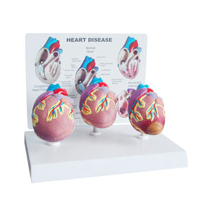 Model penyakit jantung medis 3 buah, Model anatomi jantung manusia ukuran alami, organ Sains jantung pendidikan - Product Image 1