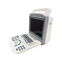 SYA-150_VET Portable Pregnancy Veterinary Color Ultrasound Machine & Used for Clinical Ultrasound Examination Zoncare I50